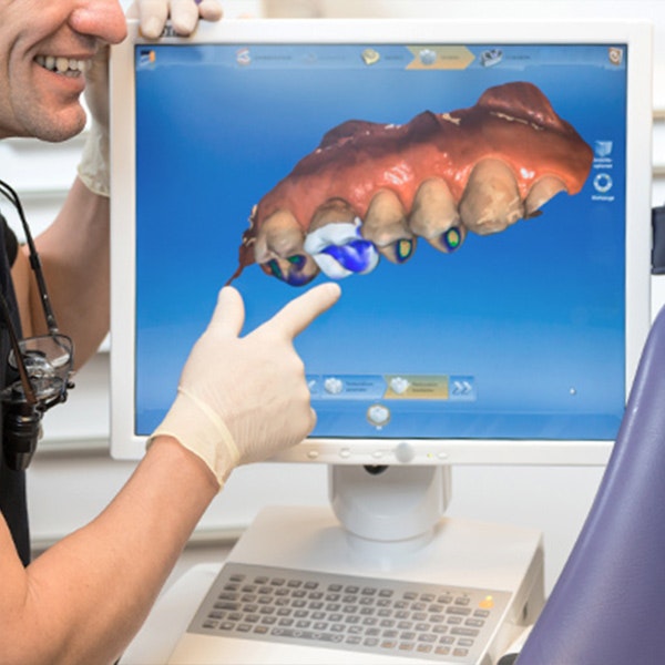 Dentist explaining the CEREC system