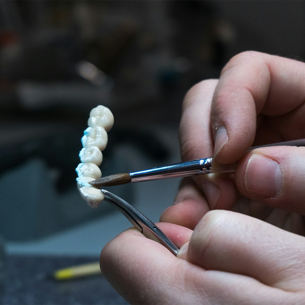 Dental crown creation